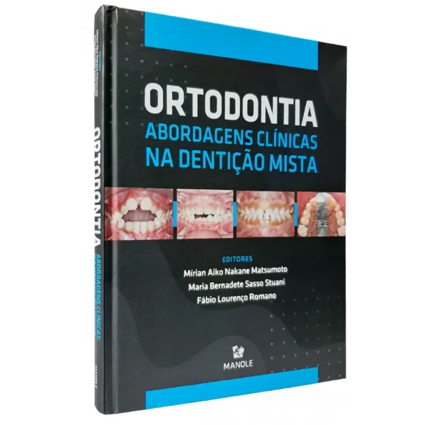 Ortodontia - Abordagens Clínicas Na Dentição Mista