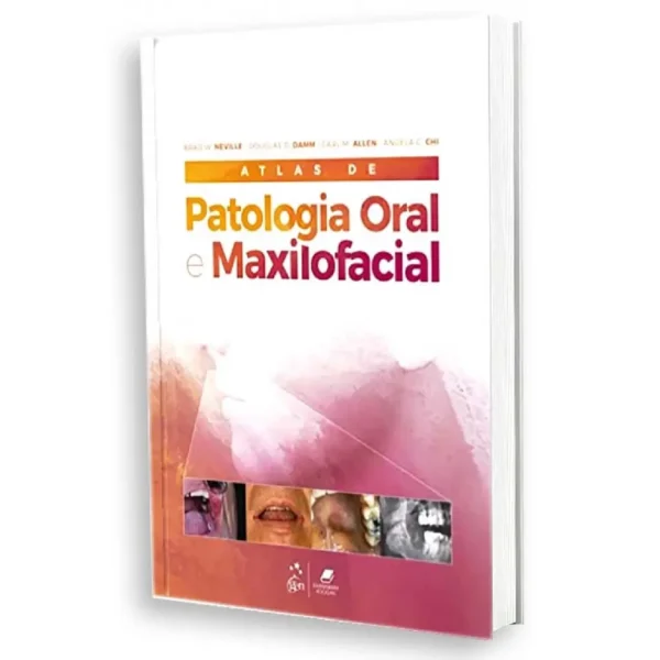 Atlas De Patologia Oral E Maxilofacial