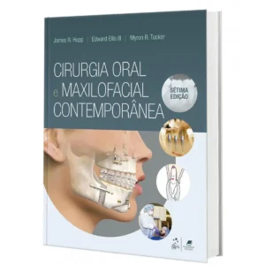 Cirurgia Oral E Maxilofacial Contemporânea