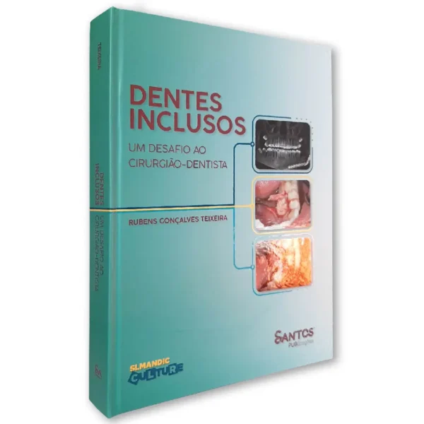 Dentes Inclusos - Um Desafio Ao Cirurgião Dentista