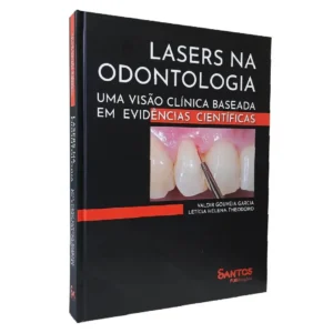 Lasers Na Odontologia • Uma Visão Clínica Baseada Em Evidências Científicas