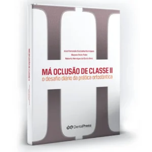 Má Oclusão De Classe Ii: O Desafio Diário Da Prática Ortodôntica