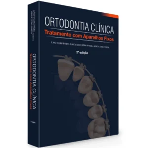 Ortodontia Clinica Tratamento Com Aparelhos Fixos