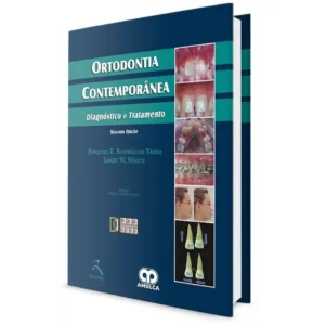 Ortodontia Contemporânea - Diagnóstico E Tratamento