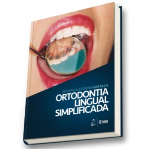 Ortodontia Lingual Simplificada