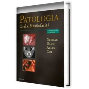 Patologia Oral E Maxilofacial - 4ª Edição