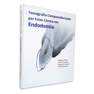 Tomografia Computadorizada Por Feixe Cônico Em Endodontia