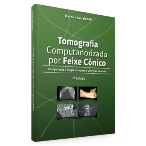 Tomografia Computadorizada Por Feixe Cônico - Interpretação E Diagnóstico Para O Cirurgião-Dentista - 3ª Edição