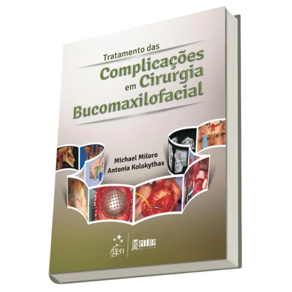 Tratamento Das Complicações Em Cirurgia Bucomaxilofacial