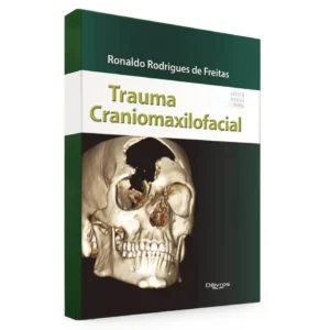 Trauma Craniomaxilofacial