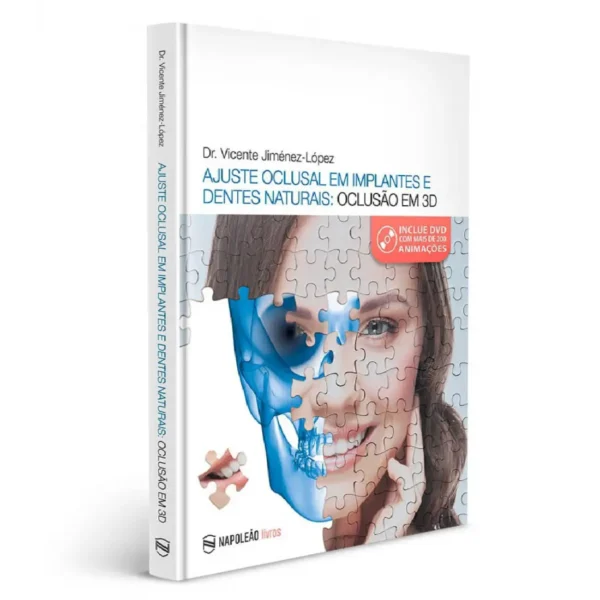 Ajuste Oclusal Em Implantes E Dentes Naturais: Oclusão Em 3D – Vicente Jiménez-Lépez