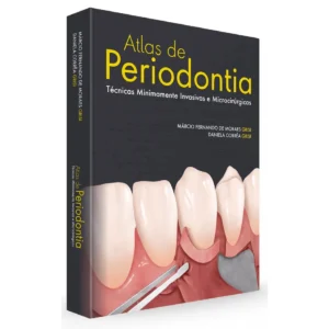 Atlas De Periodontia