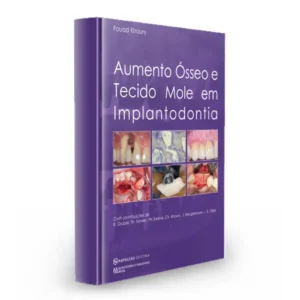 Aumento Ósseo E Tecido Mole Em Implantodontia