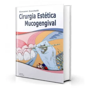 Cirurgia Estética Mucogengival