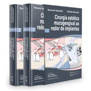 Cirurgia Estética Mucogengival Ao Redor De Implantes - Volume 1 E Volume 2