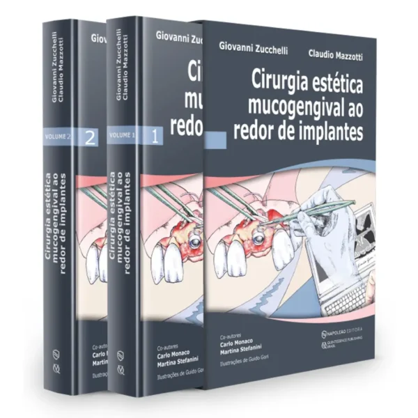 Cirurgia Estética Mucogengival Ao Redor De Implantes - Volume 1 E Volume 2