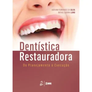 Dentística Restauradora - Do Planejamento À Execução