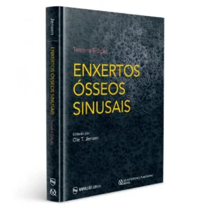 Enxertos Ósseos Sinusais