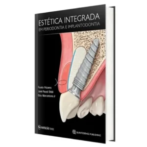 Estética Integrada Em Periodontia E Implantodontia