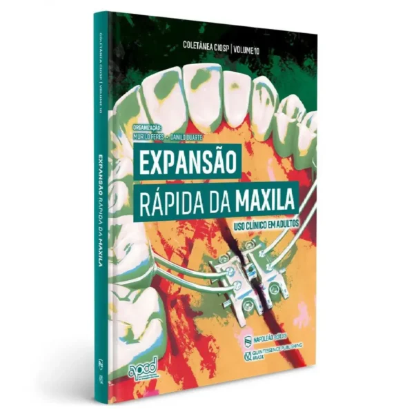 Expansão Rápida Da Maxila