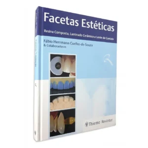 Facetas Estéticas - Resina Composta, Laminado Cerâmico E Lente De Contato