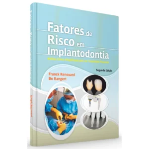 Fatores De Risco Em Implantodontia - Análise Clínica Simplificada Para Um Tratamento Previsível