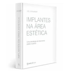 Implantes Na Área Estética – Uma Estratégia De Tratamento Passo-A-Passo