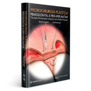 Microcirurgia Plástica Periodontal E Peri-Implantar