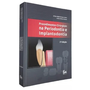 Procedimentos Cirúrgicos Na Periodontia E Implantodontia
