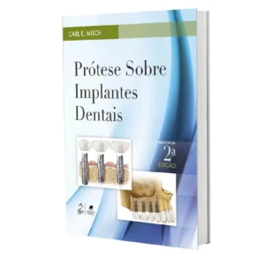 Prótese Sobre Implantes Dentais