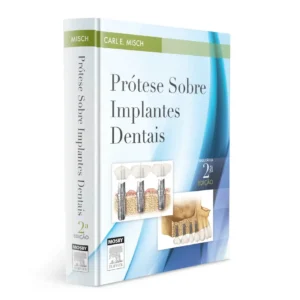 Prótese Sobre Implantes Dentais