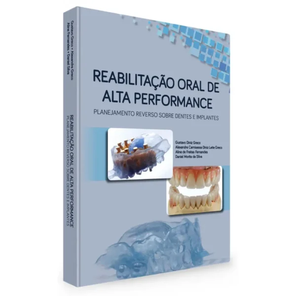 Reabilitação Oral De Alta Performance: Planejamento Reverso Sobre Dentes E Implantes