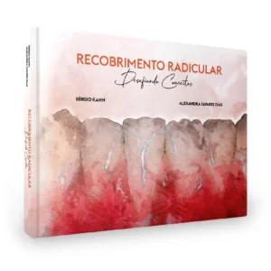 Recobrimento Radicular – Desafiando Conceitos