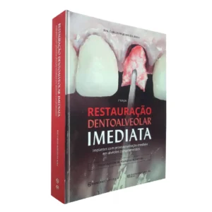 Restauração Dentoalveolar Imediata - Implantes Com Provisionalização Imediata Em Alvéolos Comprometidos