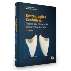 Restaurações Cerâmicas: Detalhes Para Obtenção Da Estética E Previsibilidade