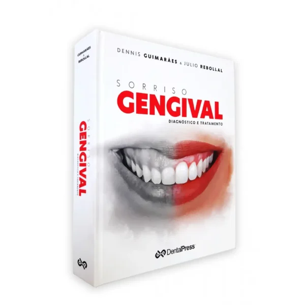 Sorriso Gengival - Diagnóstico E Tratamento