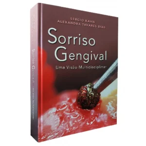 Sorriso Gengival • Uma Visão Multidiciplinar