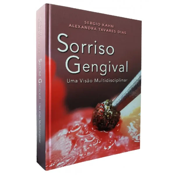 Sorriso Gengival • Uma Visão Multidiciplinar