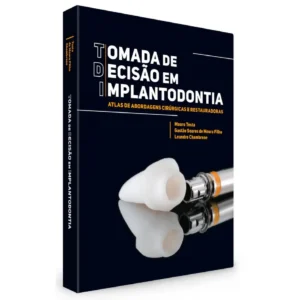 Tomada De Decisão Em Implantodontia Atlas De Abordagens Cirúrgicas E Restauradoras