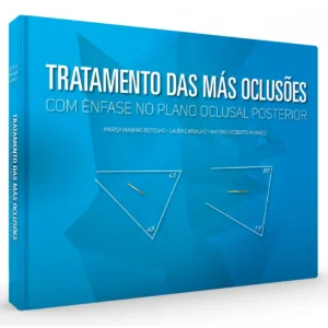 Tratamento Das Mas Oclusões - Com Ênfase No Plano Oclusal Posterior