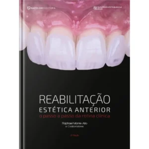 Reabilitação Estética Anterior - O Passo A Passo Da Rotina Clínica 2º Edição