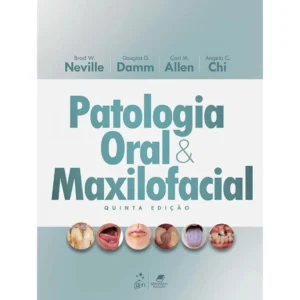 Patologia Oral E Maxilofacial