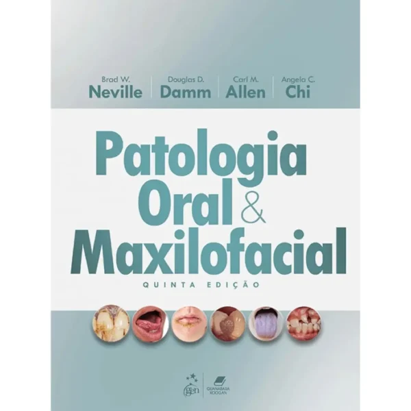 Patologia Oral E Maxilofacial